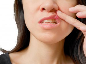 Colibacillus szag a szájból - Colibacillus férfiak kenetében, A baktériumok okai