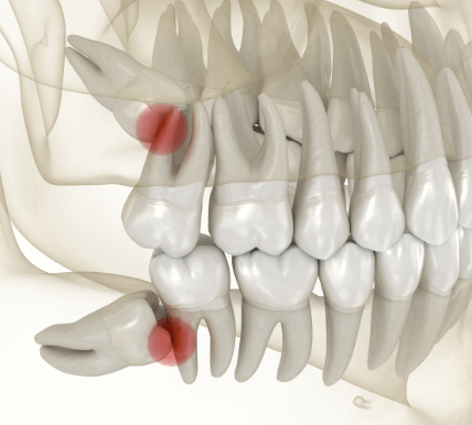 Kiváltott problémák