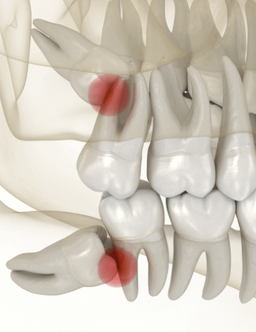 Kiváltott problémák